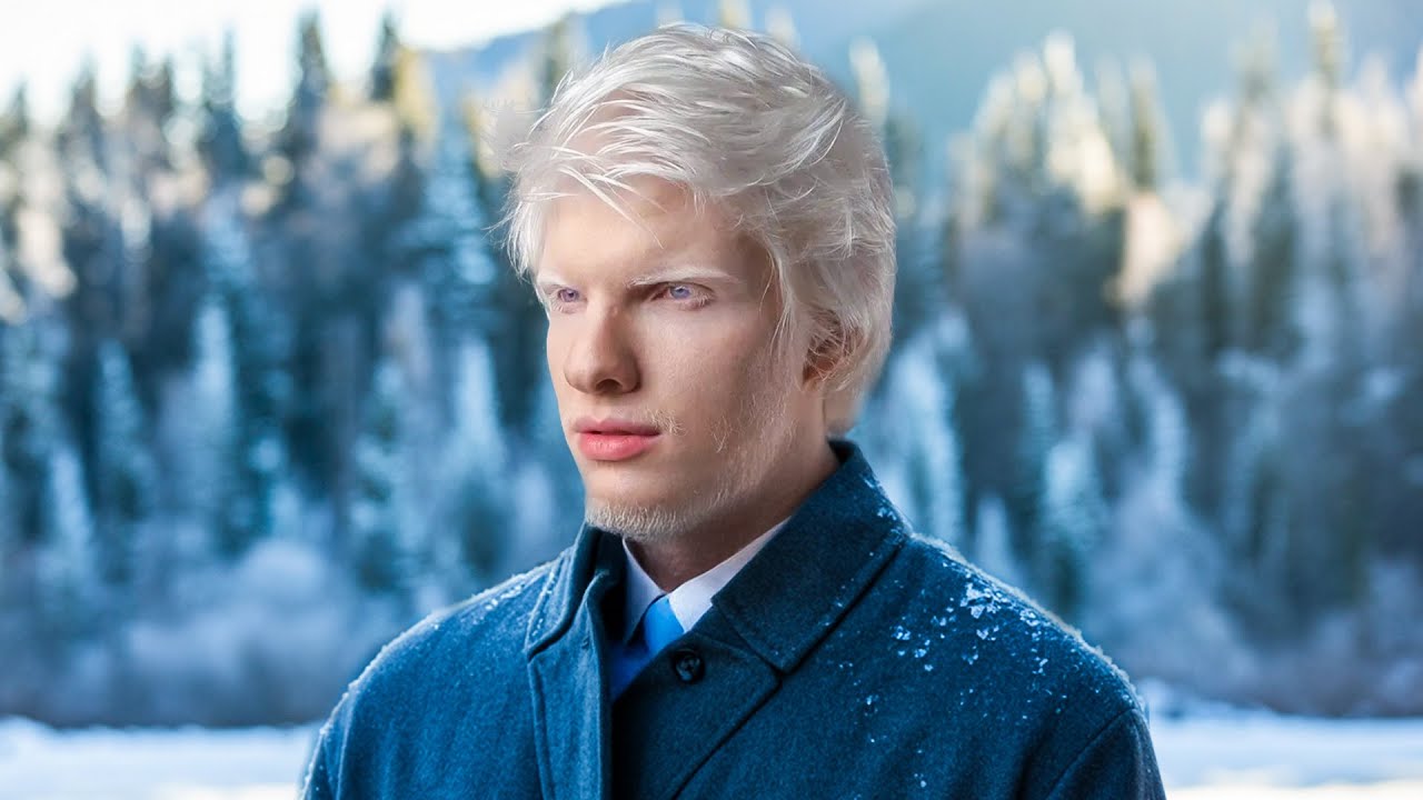 He's The World's Most Famous Albino 25 hq720 1202