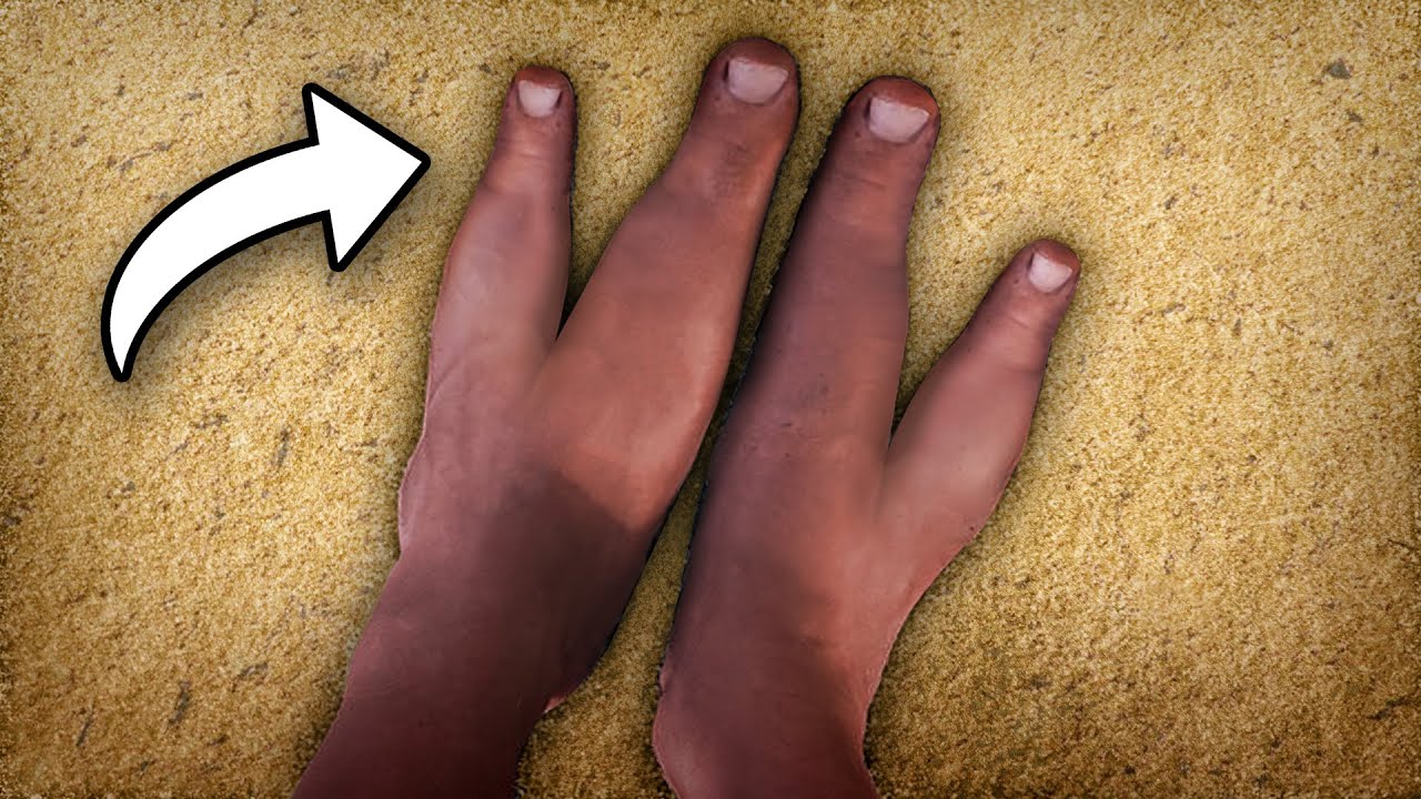 This African Tribe Has Only 2 Toes 23 hq720 587